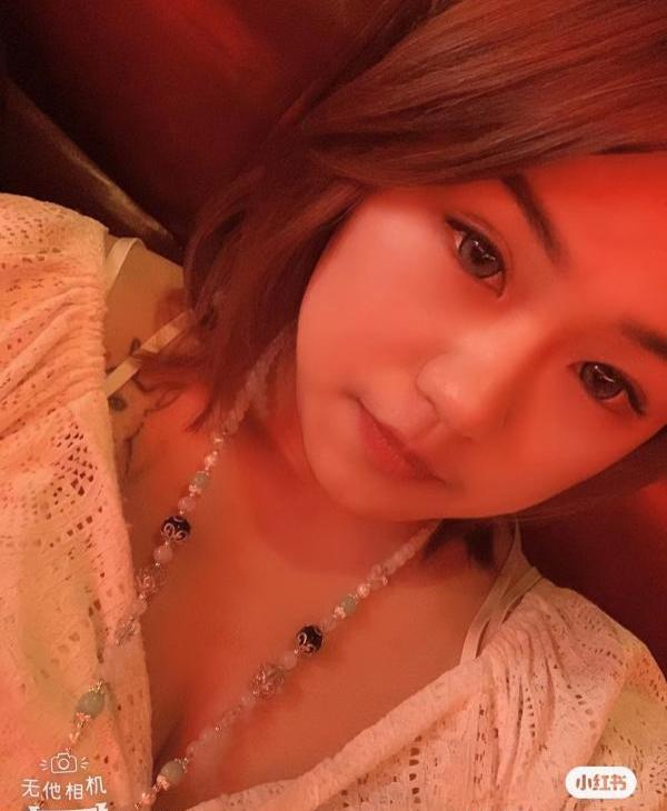 浑南 畸形 水娃